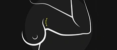 Axillary-(Armpit)-img